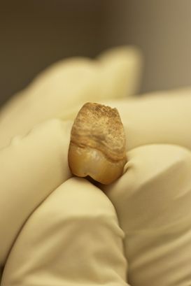 Il dente di Naia usato sia per le analisi e la datazione al radiocarbonio, sia per l'estrazione del DNA. Lo smalto ben conservato della corona dentale ha permesso di estrarre un frammento di DNA in perfette condizioni (James Chatters)